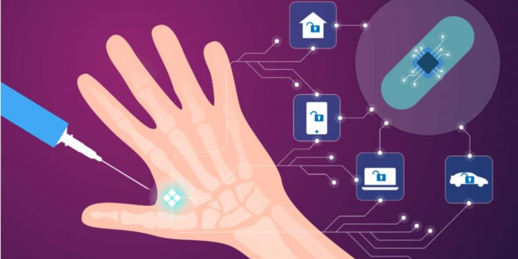 Microchip tracking for people with dementia